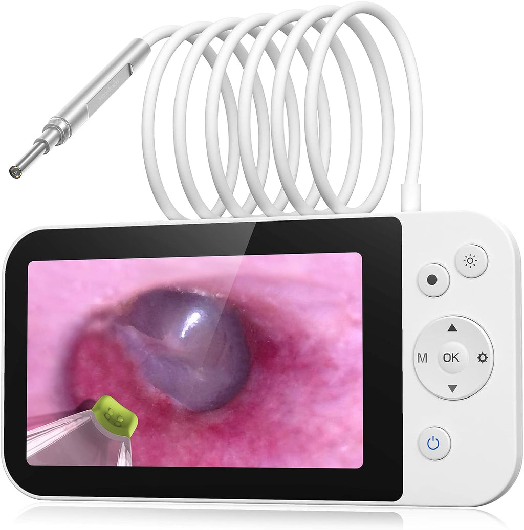Ear Wax Removal Tool with 5 Inches Screen and Light Z31141